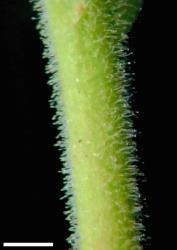 Veronica lavaudiana. Inflorescence glandular hairs. Scale = 1 mm.
 Image: P.J. Garnock-Jones © Te Papa CC-BY-NC 3.0 NZ
